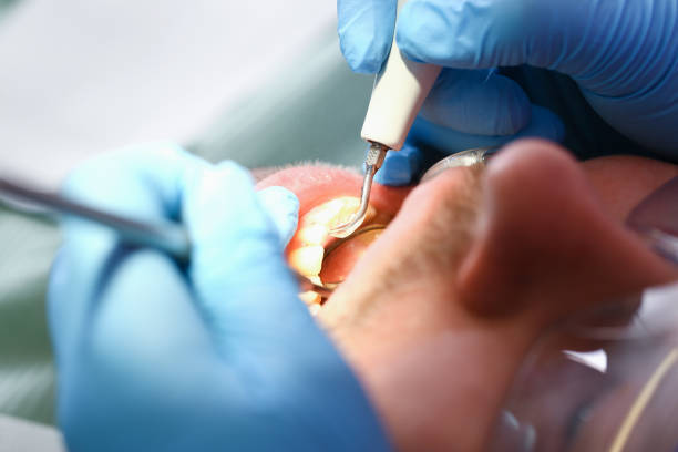 Best Tooth Infection Emergency Dentist  in Stonewood, WV