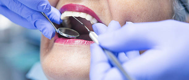 Best Knocked-Out Tooth Emergency  in Stonewood, WV
